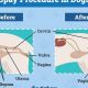 Ultimate Dog Spay Aftercare Guide | My Caring Dog – Tips, Stories, and Care Guides for Loving Pet Owners
